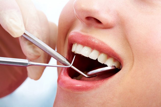 Viêm nha chu có thể được điều trị bằng cách lấy đi hết cao răng