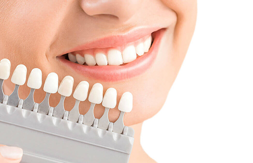 Răng sứ Emax chất liệu hoàn hảo, chịu lực siêu bền