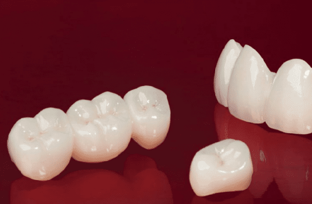 Răng sứ Ceramill Zolid là một trong những dòng răng sứ được ưa chuộng nhất hiện nay