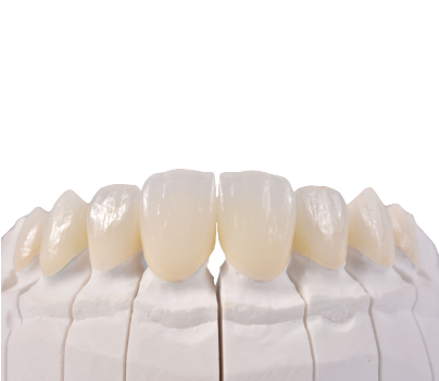 Răng sứ Siladent được chế tác từ công nghệ nha khoa đẳng cấp và uy tín