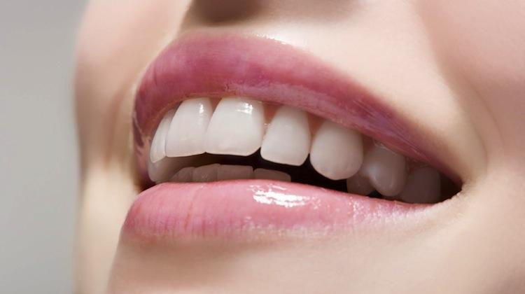 Dán sứ sườn Ziconia đang là công nghệ thẩm mỹ răng tiên tiến bậc nhất